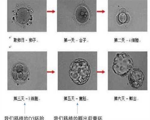 无精不育